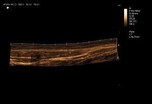 Panoramic Imaging(001)