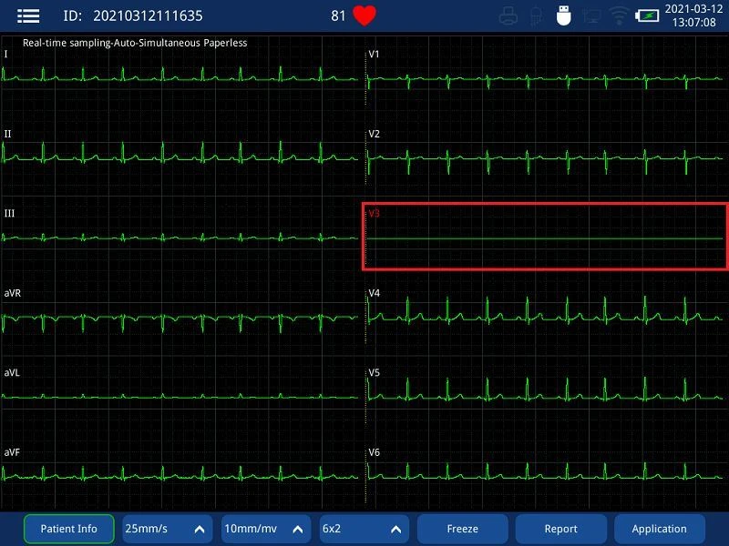 WiFi 12 channel ECG machine(001)