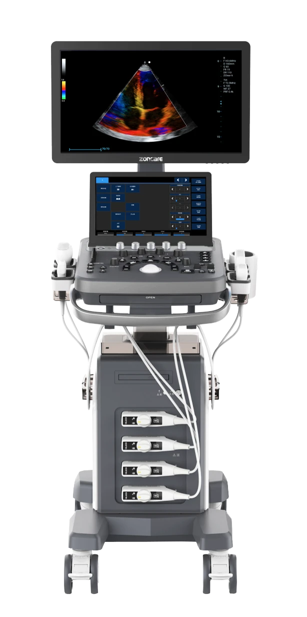 Compact Color Doppler Ultrasound