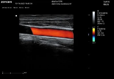Intelligent blood flow tracking Intelligent blood flow tracking
